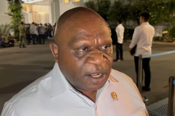 natius pigai